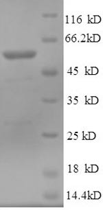 Cytosolic 5'-nucleotidase 1A (NT5C1A), human, recombinant