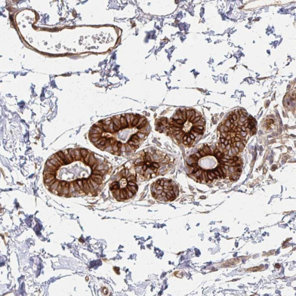 Anti-ARHGAP35