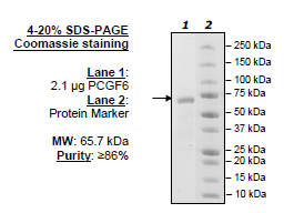 PCGF6, GST-tag, Human recombinant protein