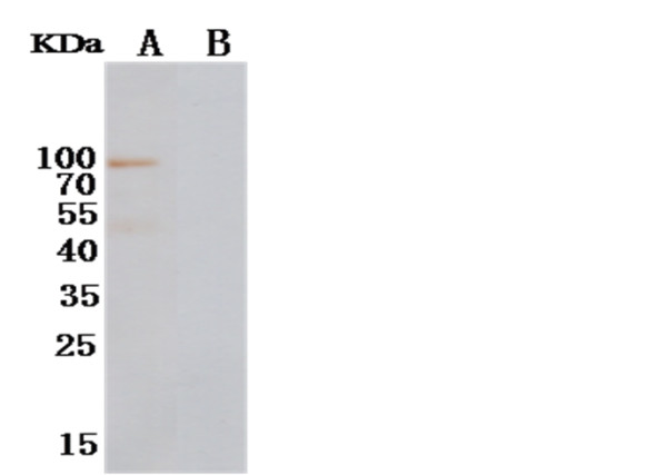 Anti-NRG1-beta 1 Monoclonal Antibody