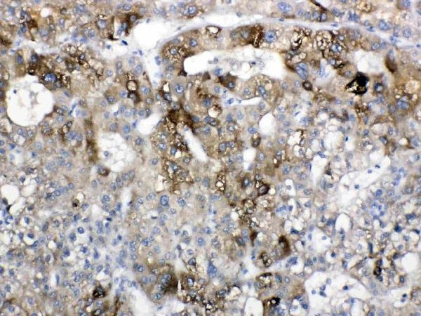 Anti-CYP2D6