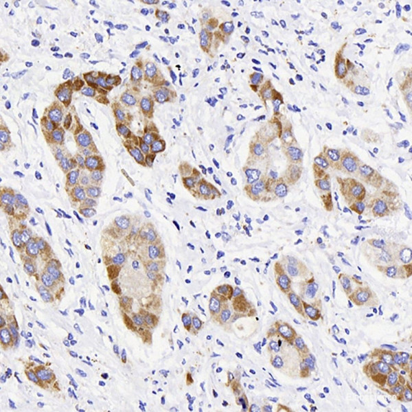 Anti-ATG5