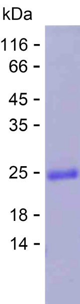 Recombinant Human TMEM123 Protein