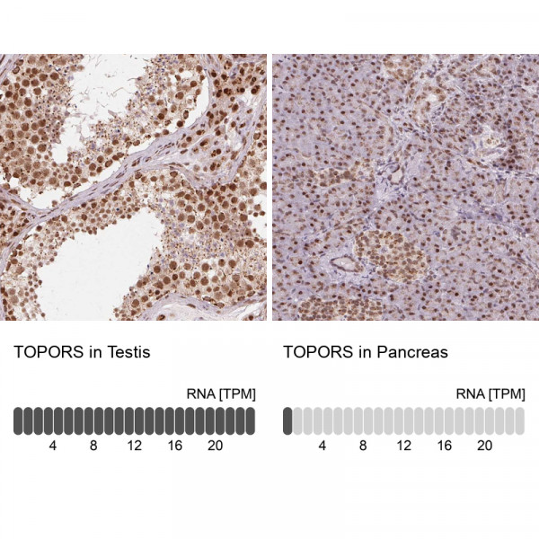 Anti-TOPORS