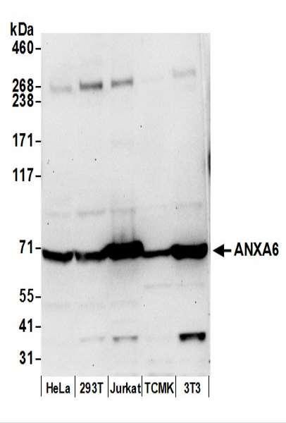 Anti-ANXA6