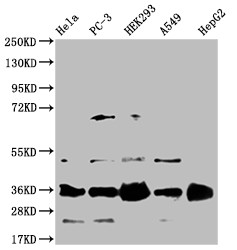 Anti-HMGCL Recombinant Monoclonal, clone 22H11