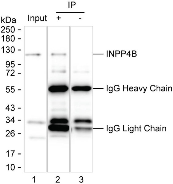 Anti-INPP4B