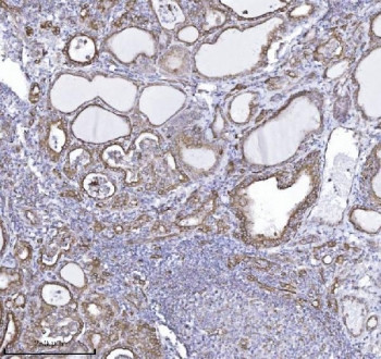 Anti-Drebrin 1, clone 4F6E7