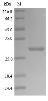 Polymerase acidic protein (PA), partial, Influenza A virus, recombinant