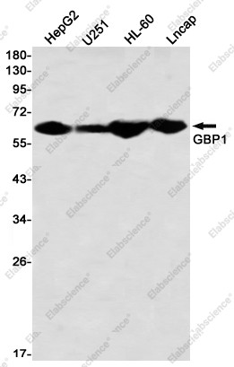 Anti-Recombinant GBP1, clone C312807