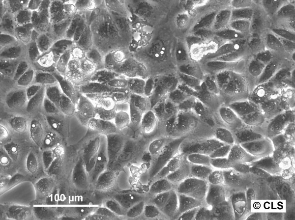 ACHN Cells