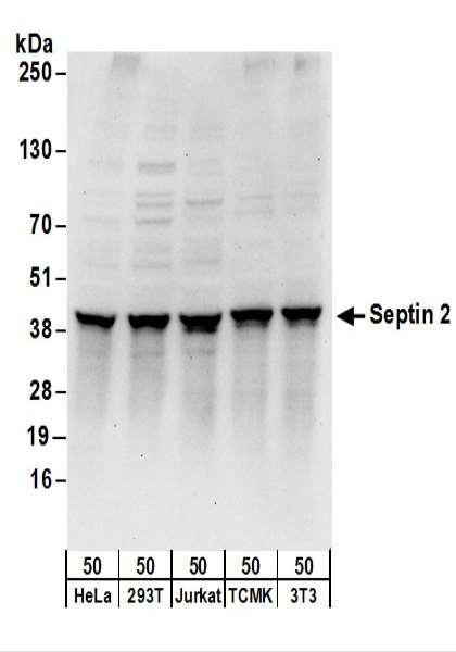 Anti-Septin 2