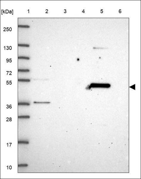 Anti-NPRL3