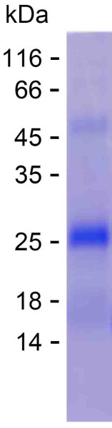 Recombinant Human ERVK-24 Protein
