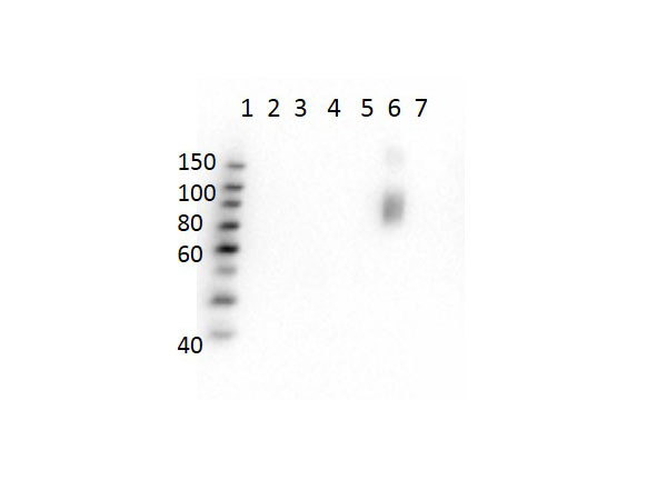 Anti-Hemoglobin beta S, clone 23E5.H6.G6.C1.H7.F7.G9.F6