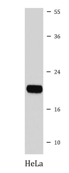 Anti-Ferritin Heavy Chain
