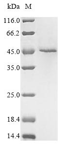 Receptor-interacting serine/threonine-protein kinase 1 (RIPK1), partial, human, recombinant