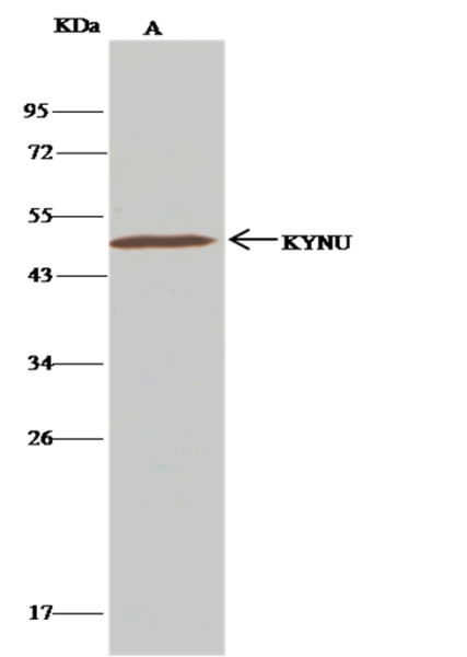 Anti-KYNU Monoclonal Recombinant Antibody