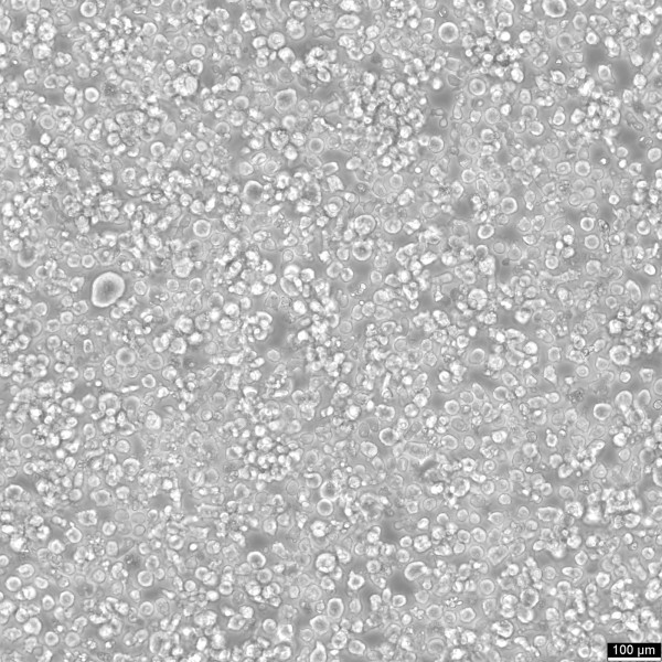 L-540 Cells