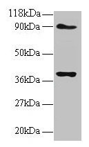 Anti-NDUFS5
