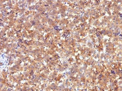 Anti-AFP (Alpha Fetoprotein) (Hepatocellular/Germ Cell Tumor Marker)(Clone: C2)