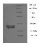 Zinc finger protein GLI1 (GLI1), partial, human, recombinant