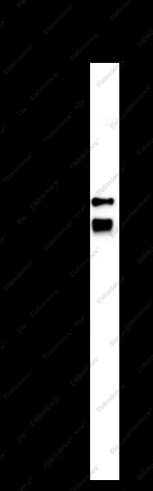 Anti-Recombinant PCSK9, clone C772183