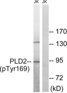 Anti-Phospho-PLD2 (Tyr169)