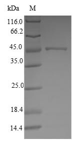 ATP synthase subunitd, mitochondrial (ATP5H), human, recombinant