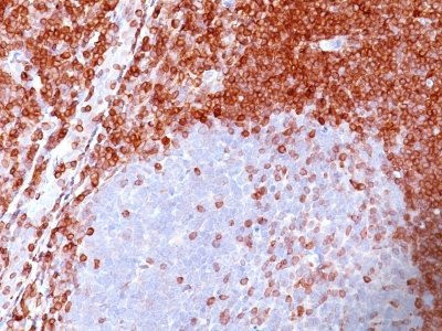 Anti-bcl-2(100/D5), CF568 conjugate, 0.1mg/mL