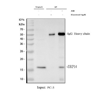 Anti-SRP14 / Signal recognition particle 14 kDa protein