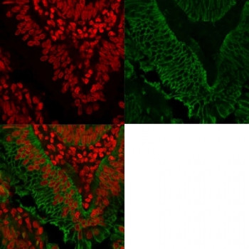 Anti-EpCAM / Extracellular domain, clone EGP40/1372