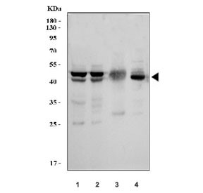 Anti-MKK7 (MEK7)