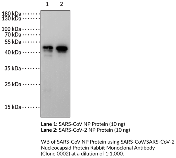 Anti-SARS-CoV/SARS-CoV-2 Nucleocapsid Protein Rabbit Monoclonal (Clone 0002)