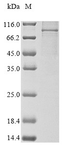 Transcription factor IIIB 90 kDa subunit (BRF1), human, recombinant