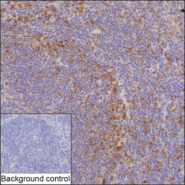 Anti-PTPN1