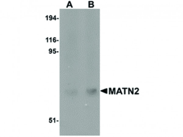 Anti-MATN2