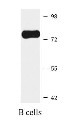 Anti-MMP9