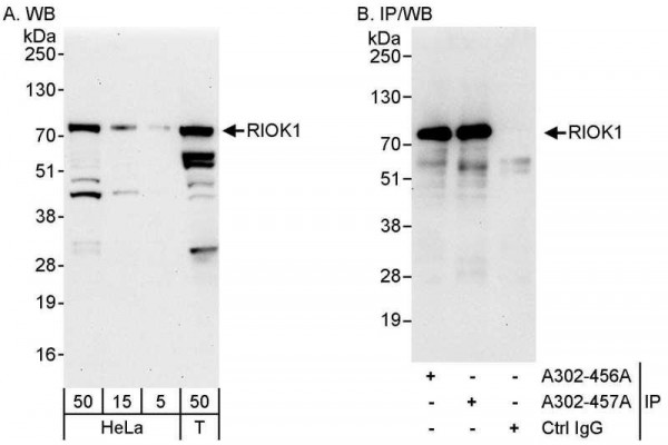 Anti-RIOK1