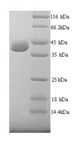 UV excision repair protein RAD23 homolog A (RAD23A), human, recombinant
