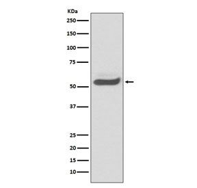 Anti-Alpha 1 Antitrypsin / AAT / SERPINA1, clone AOEF-19