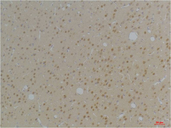Anti-KVbeta1