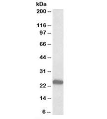 Anti-GM2A
