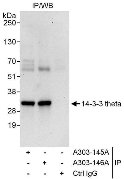 Anti-14-3-3 theta