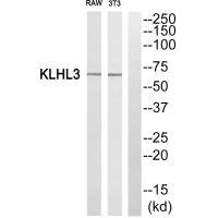 Anti-KLHL3