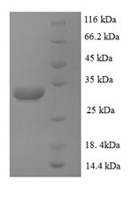 Zinc transporter ZIP1 (SLC39A1), partial, recombinant human