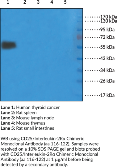 Anti-CD25/Interleukin-2Ralpha Chimeric Monoclonal Antibody (aa 116-122) (Clone Basiliximab)