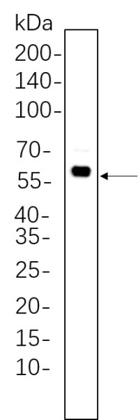 Anti-Recombinant Phospho-Akt (Thr308), clone 9C12