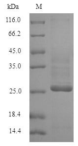 Potassium voltage-gated channel subfamily D member 1 (KCND1), partial, human, recombinant