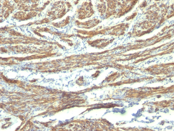 Anti-Caldesmon, HMW (h-Caldesmon) (Smooth Muscle Marker), clone CALD1/820 + h-CALD